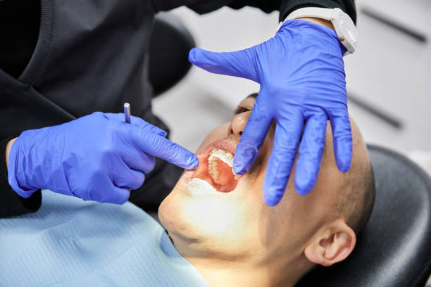 Best Emergency Tooth Extraction in Melrose, MN